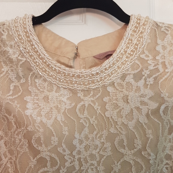 H&M Lace Dress - Picture 2 of 12